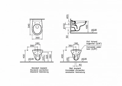 Унитаз подвесной Vitra Normus 9773B003-7206 с инсталляцией, с крышкой микролифт, белый